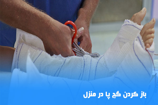 باز كردن گچ پا در منزل